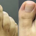 Spray Anti Hongos – Con Veneno de Abeja Natural 🐝 + ENVÍO GRATIS