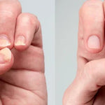 Spray Anti Hongos – Con Veneno de Abeja Natural 🐝 + ENVÍO GRATIS