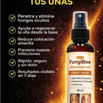 Spray Anti Hongos – Con Veneno de Abeja Natural 🐝 + ENVÍO GRATIS