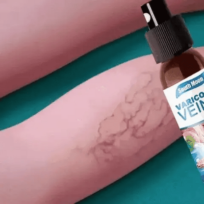 🌿VARICOSE SPRAY HERBAL ANTI-VARICES: Desinflama y Mejora las Varices y las Arañitas + ENVIO GRATIS