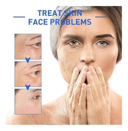 Botox Stock Solution® – Suero Hidratante y Revitalizante + ENVÍO GRATIS