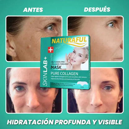 NaturalFul® Parches De Colágeno Absorbentes ✨❤️ + ENVÍO GRATIS 🚚