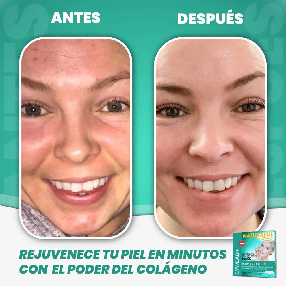 NaturalFul® Parches De Colágeno Absorbentes ✨❤️ + ENVÍO GRATIS 🚚